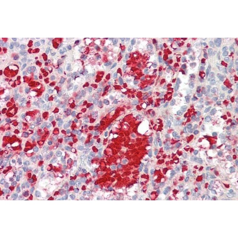 Immunohistochemistry - Anti-IGF1 Antibody (A83119) - Antibodies.com