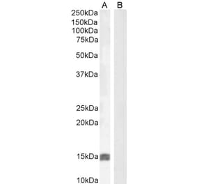 Western Blot - Anti-IGF1 Antibody (A83119)