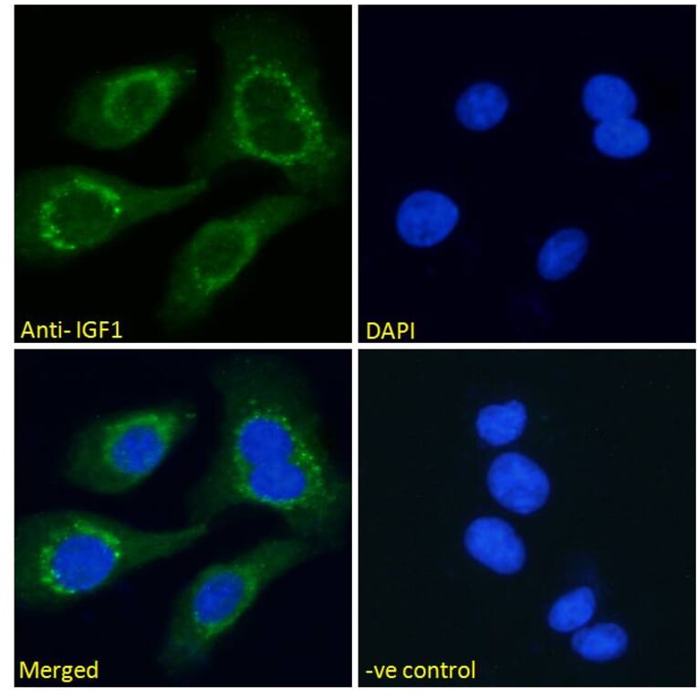 Immunofluorescence - Anti-IGF1 Antibody (A83119) - Antibodies.com