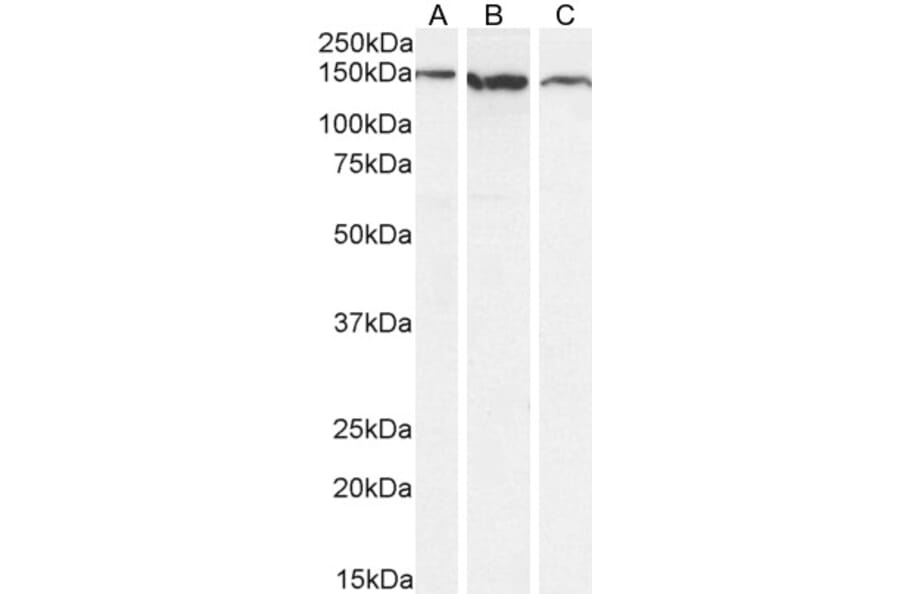 Western Blot - Anti-EVI1 Antibody (A83120) - Antibodies.com