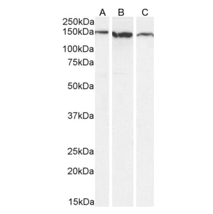 Western Blot - Anti-EVI1 Antibody (A83120) - Antibodies.com