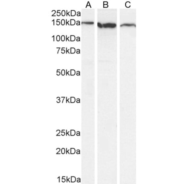 Western Blot - Anti-EVI1 Antibody (A83120) - Antibodies.com