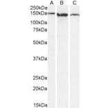 Western Blot - Anti-EVI1 Antibody (A83120) - Antibodies.com
