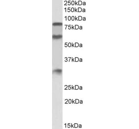 Western Blot - Anti-LMW Kininogen Antibody (A83121) - Antibodies.com