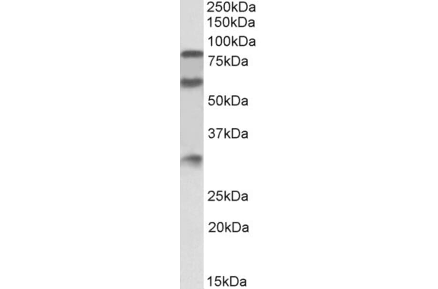 Western Blot - Anti-LMW Kininogen Antibody (A83121) - Antibodies.com