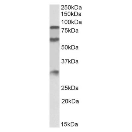 Western Blot - Anti-LMW Kininogen Antibody (A83121) - Antibodies.com