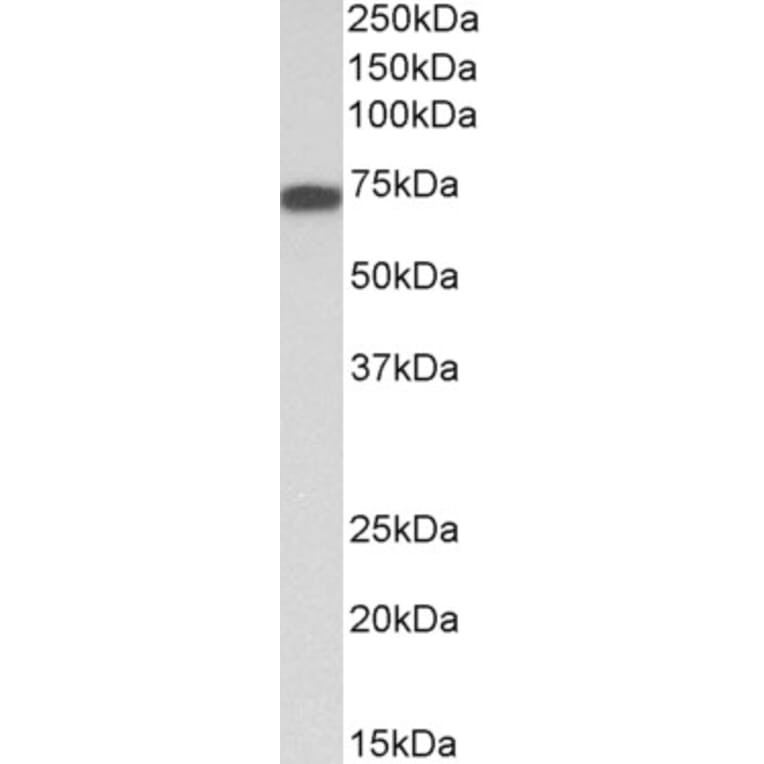 Western Blot - Anti-LMW Kininogen Antibody (A83122) - Antibodies.com
