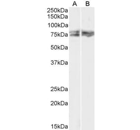 Western Blot - Anti-LIMK2 Antibody (A83123) - Antibodies.com