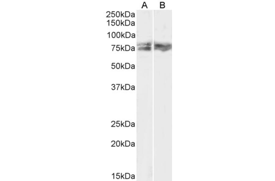 Western Blot - Anti-LIMK2 Antibody (A83123) - Antibodies.com