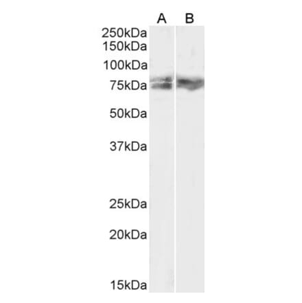 Western Blot - Anti-LIMK2 Antibody (A83123) - Antibodies.com