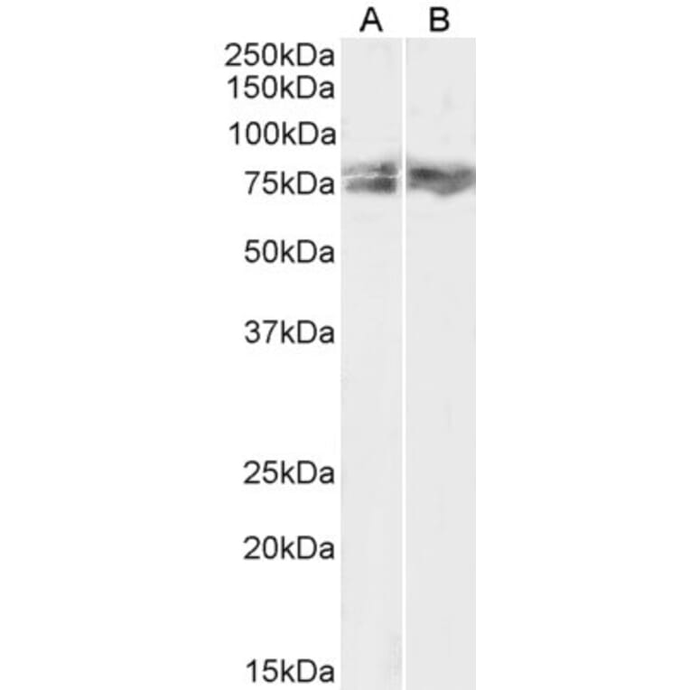 Western Blot - Anti-LIMK2 Antibody (A83123) - Antibodies.com