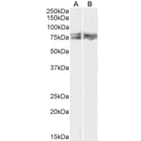 Western Blot - Anti-LIMK2 Antibody (A83123) - Antibodies.com