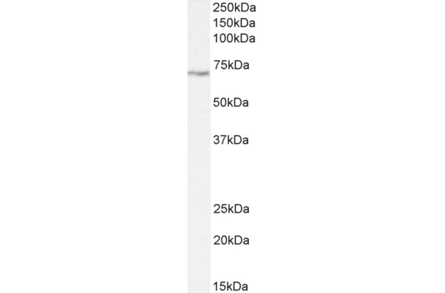 Western Blot - Anti-LIMK2 Antibody (A83123) - Antibodies.com