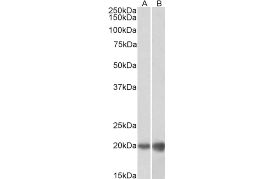 Western Blot - Anti-dUTPase Antibody (A83124) - Antibodies.com