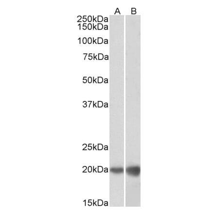 Western Blot - Anti-dUTPase Antibody (A83124) - Antibodies.com