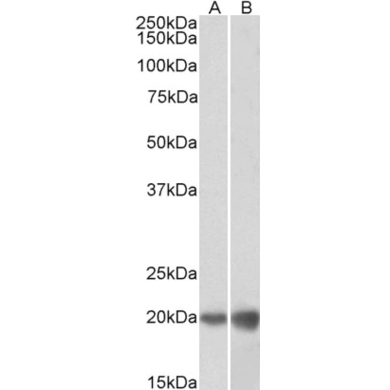 Western Blot - Anti-dUTPase Antibody (A83124) - Antibodies.com