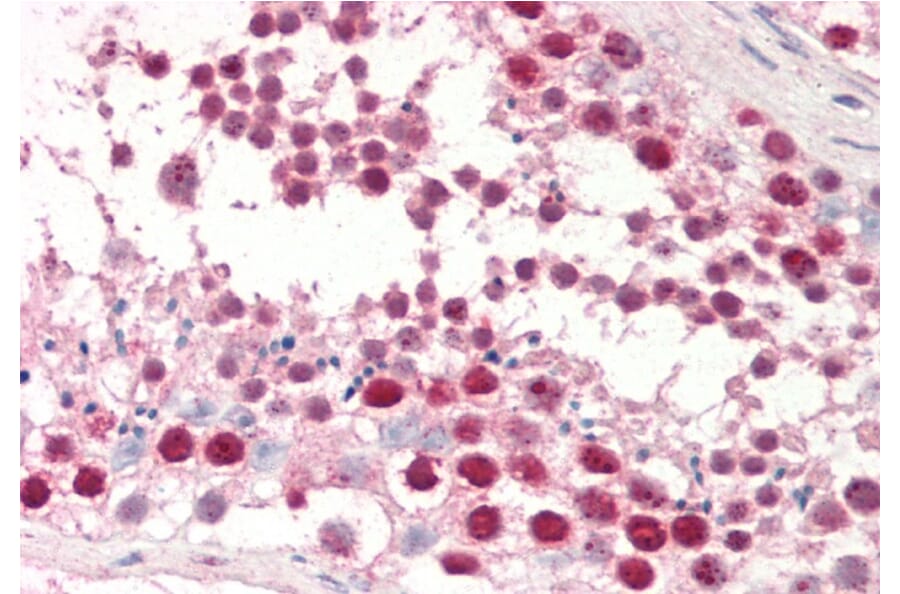 Immunohistochemistry - Anti-dUTPase Antibody (A83124) - Antibodies.com