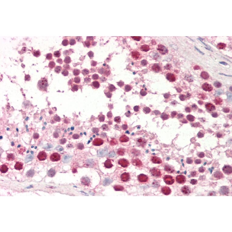 Immunohistochemistry - Anti-dUTPase Antibody (A83124) - Antibodies.com