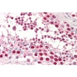 Immunohistochemistry - Anti-dUTPase Antibody (A83124) - Antibodies.com