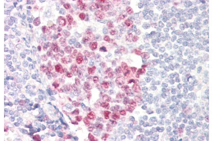 Immunohistochemistry - Anti-dUTPase Antibody (A83124) - Antibodies.com