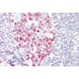 Immunohistochemistry - Anti-dUTPase Antibody (A83124) - Antibodies.com