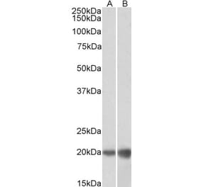 Western Blot - Anti-DUT Antibody (A83124) - Antibodies.com