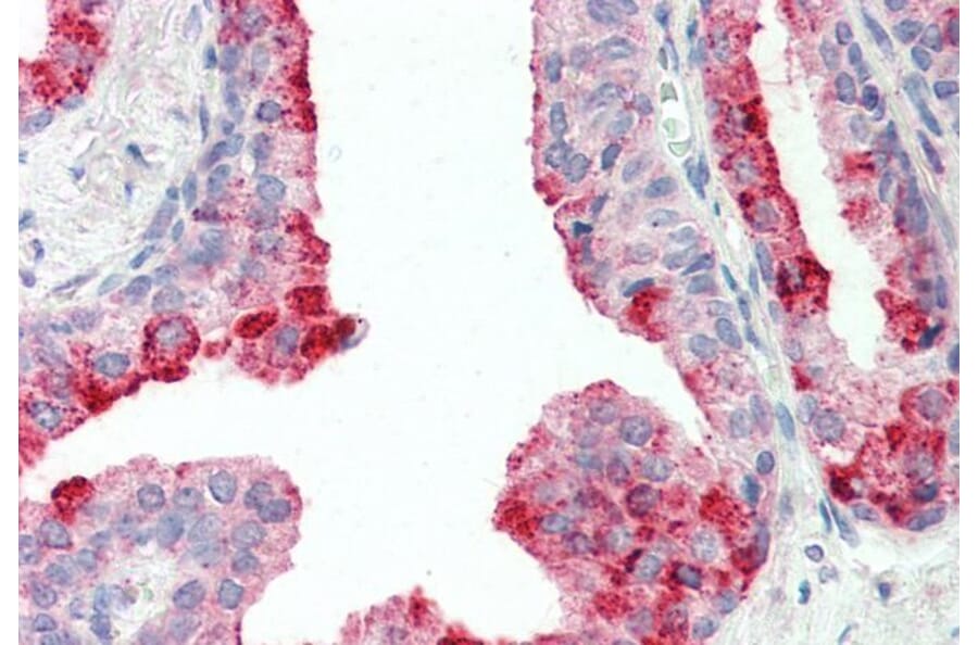 Immunohistochemistry - Anti-CutA Antibody (A83125) - Antibodies.com