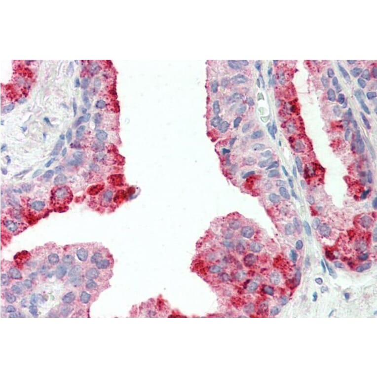 Immunohistochemistry - Anti-CutA Antibody (A83125) - Antibodies.com