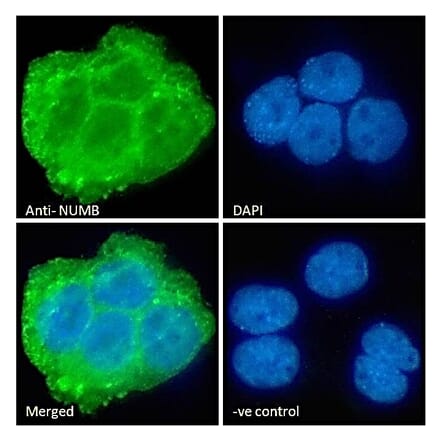 Immunofluorescence - Anti-NUMB Antibody (A83126) - Antibodies.com