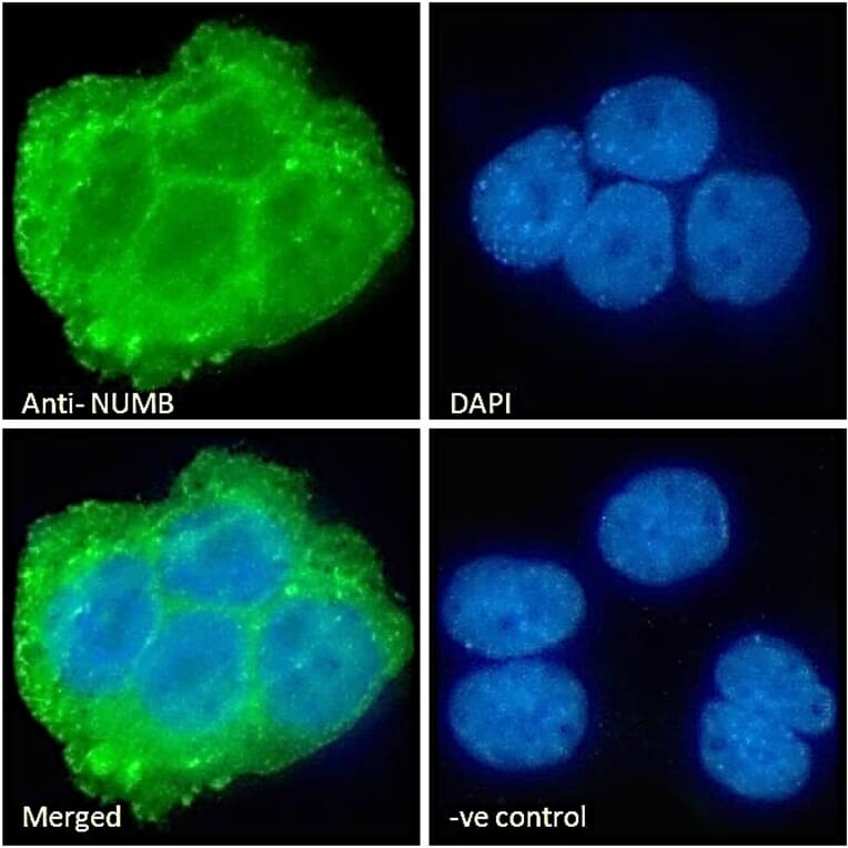 Immunofluorescence - Anti-NUMB Antibody (A83126) - Antibodies.com