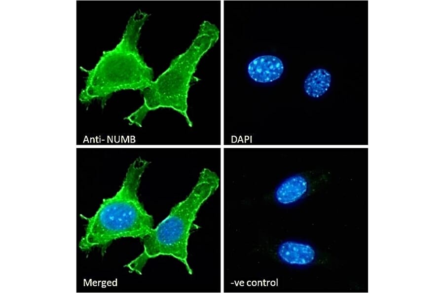 Immunofluorescence - Anti-NUMB Antibody (A83126) - Antibodies.com