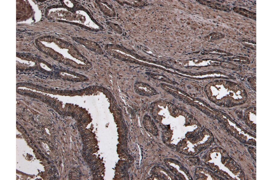Immunohistochemistry - Anti-NUMB Antibody (A83126) - Antibodies.com