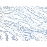 Immunohistochemistry - Anti-NUMB Antibody (A83126) - Antibodies.com