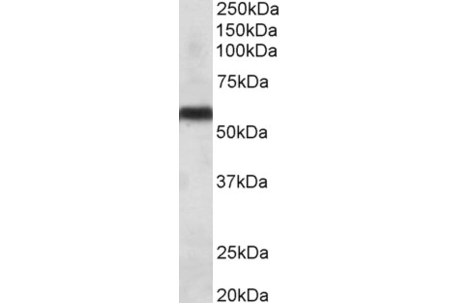 Western Blot - Anti-CYP2C8 Antibody (A83127) - Antibodies.com