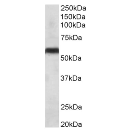 Western Blot - Anti-CYP2C8 Antibody (A83127) - Antibodies.com