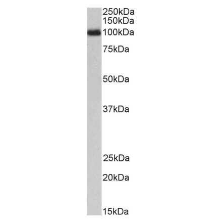 Western Blot - Anti-GCSF Receptor Antibody (A83128) - Antibodies.com