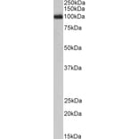 Western Blot - Anti-GCSF Receptor Antibody (A83128) - Antibodies.com