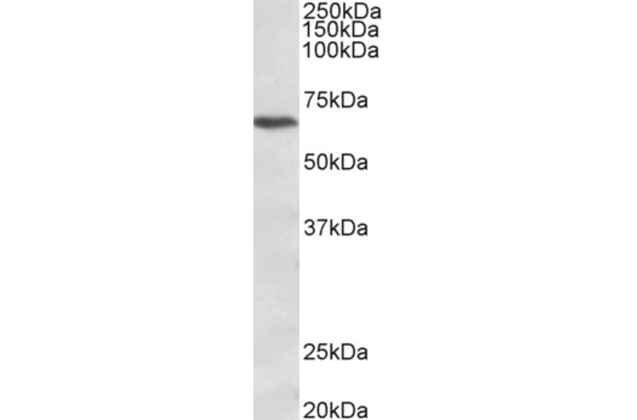 Western Blot - Anti-CACNB2 Antibody (A83129) - Antibodies.com
