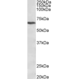 Western Blot - Anti-CACNB2 Antibody (A83129) - Antibodies.com