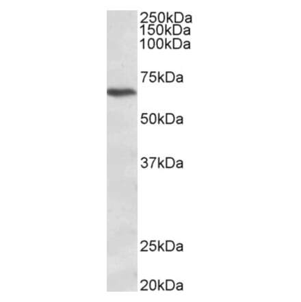 Western Blot - Anti-CACNB2 Antibody (A83129) - Antibodies.com