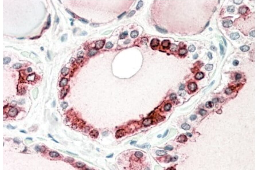 Immunohistochemistry - Anti-Thyroid Peroxidase/TPO Antibody (A83130) - Antibodies.com