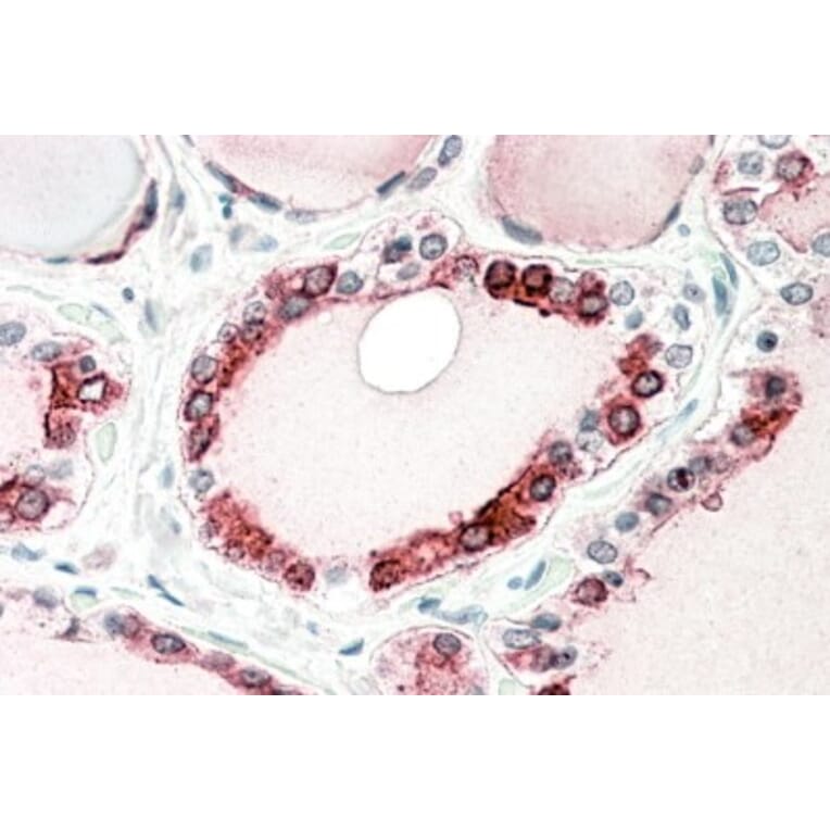 Immunohistochemistry - Anti-Thyroid Peroxidase/TPO Antibody (A83130) - Antibodies.com