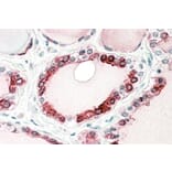 Immunohistochemistry - Anti-Thyroid Peroxidase/TPO Antibody (A83130) - Antibodies.com