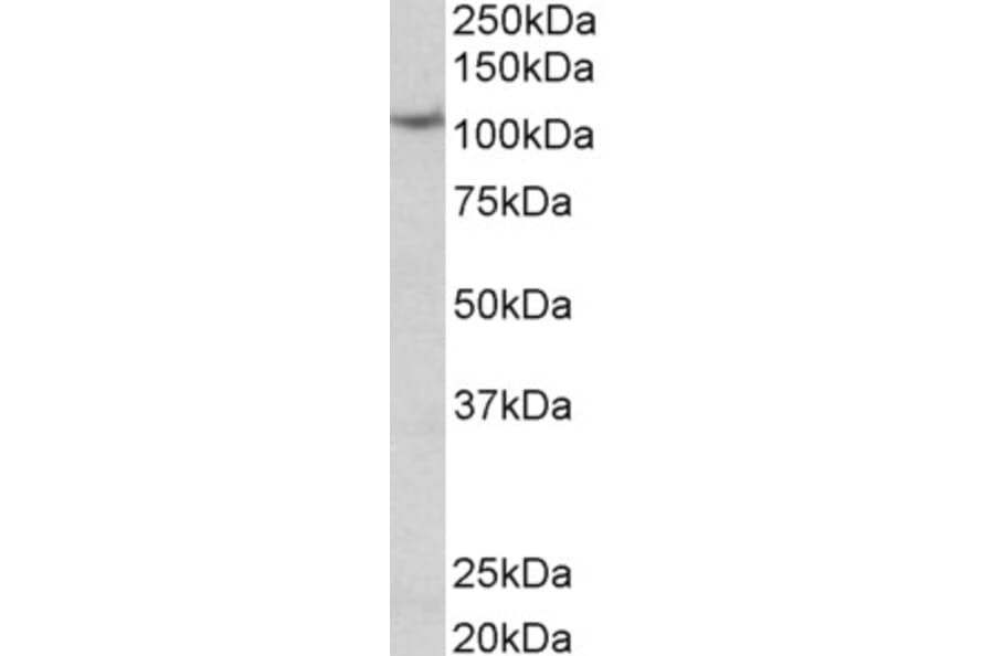 Western Blot - Anti-Thyroid Peroxidase/TPO Antibody (A83130) - Antibodies.com