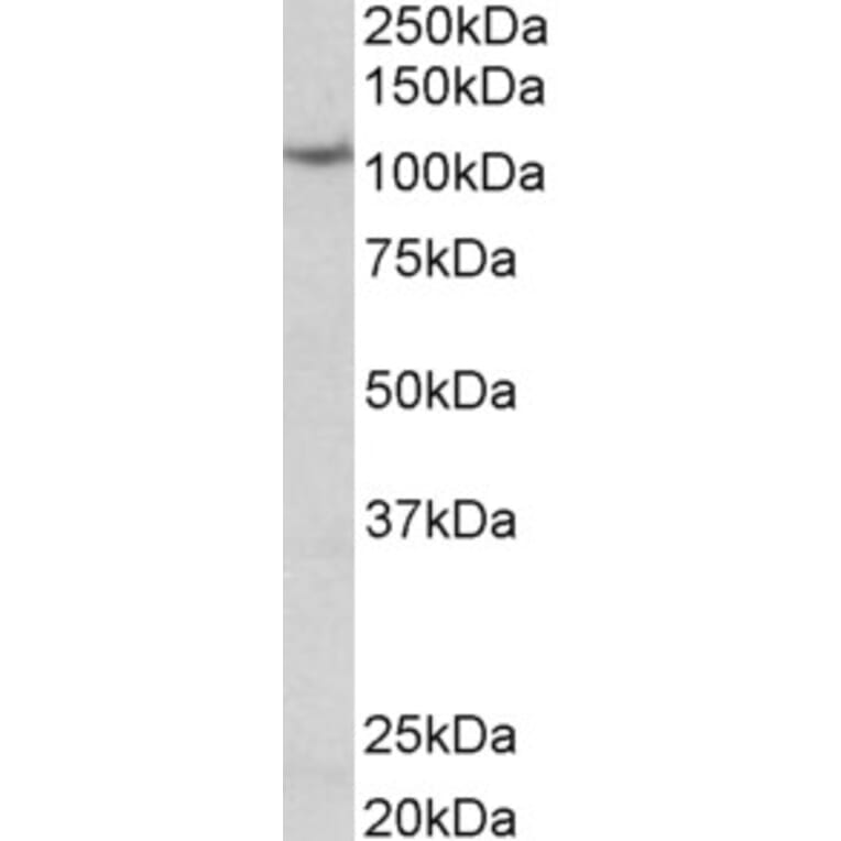 Western Blot - Anti-Thyroid Peroxidase/TPO Antibody (A83130) - Antibodies.com