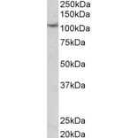 Western Blot - Anti-Thyroid Peroxidase/TPO Antibody (A83130) - Antibodies.com