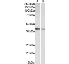 Western Blot - Anti-Cardiac Troponin T Antibody (A83132) - Antibodies.com