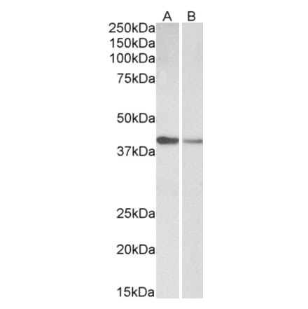 Western Blot - Anti-Cardiac Troponin T Antibody (A83132) - Antibodies.com