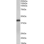 Western Blot - Anti-Cardiac Troponin T Antibody (A83132) - Antibodies.com