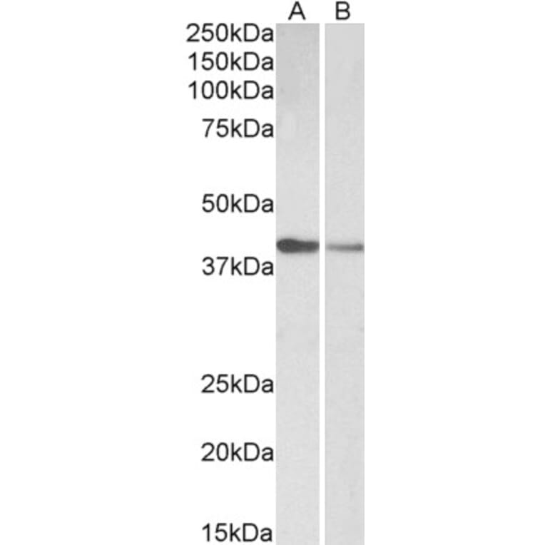 Anti-Cardiac Troponin T Antibody (A83132) | Antibodies.com